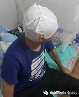 原始点调理九年史牛皮癣:二十天大变化 原始点调理九年史牛皮癣:二十天大变化