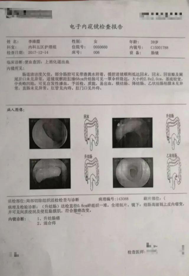 原始点调理结肠癌：境随心转