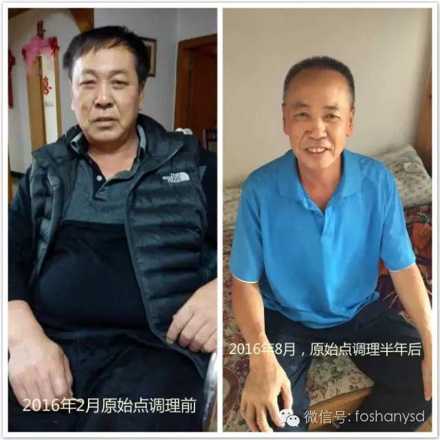 触目惊心 原始点调理八年病史牛皮癣,半年基本恢复健康 触目惊心 原始点调理八年病史牛皮癣,半年基本恢复健康