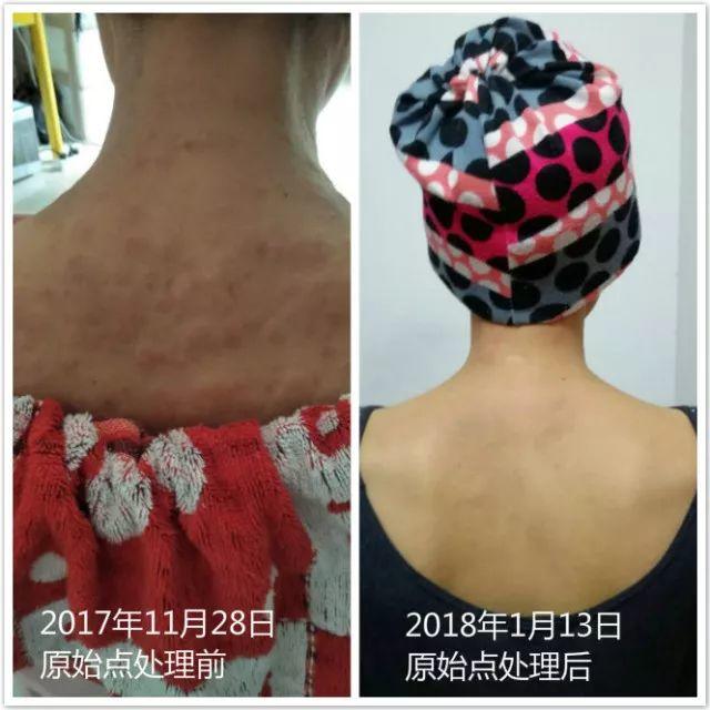 原始点调理附子中毒:细节决定成败 原始点调理附子中毒:细节决定成败