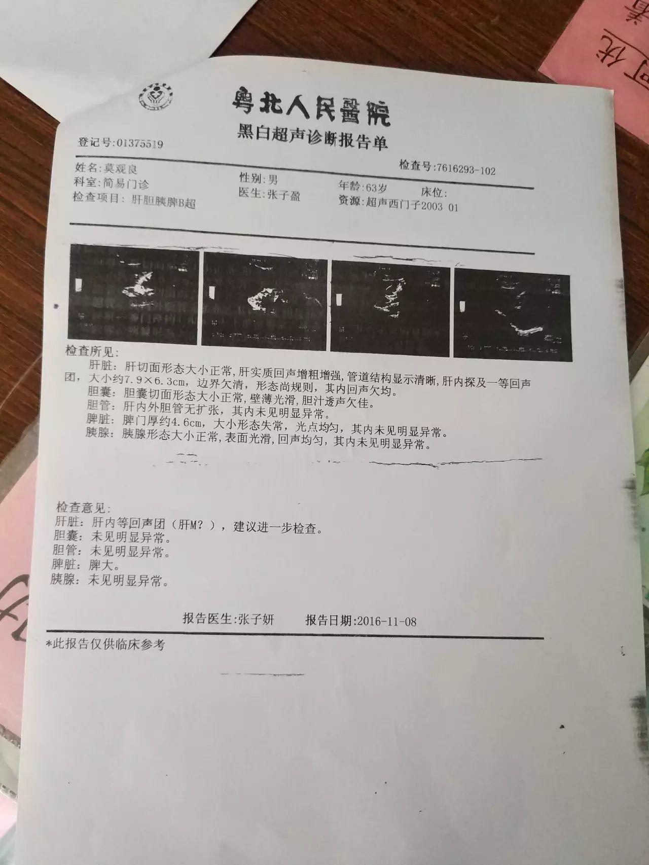 原始点调理肝癌:轻轻松松 原始点调理肝癌:轻轻松松