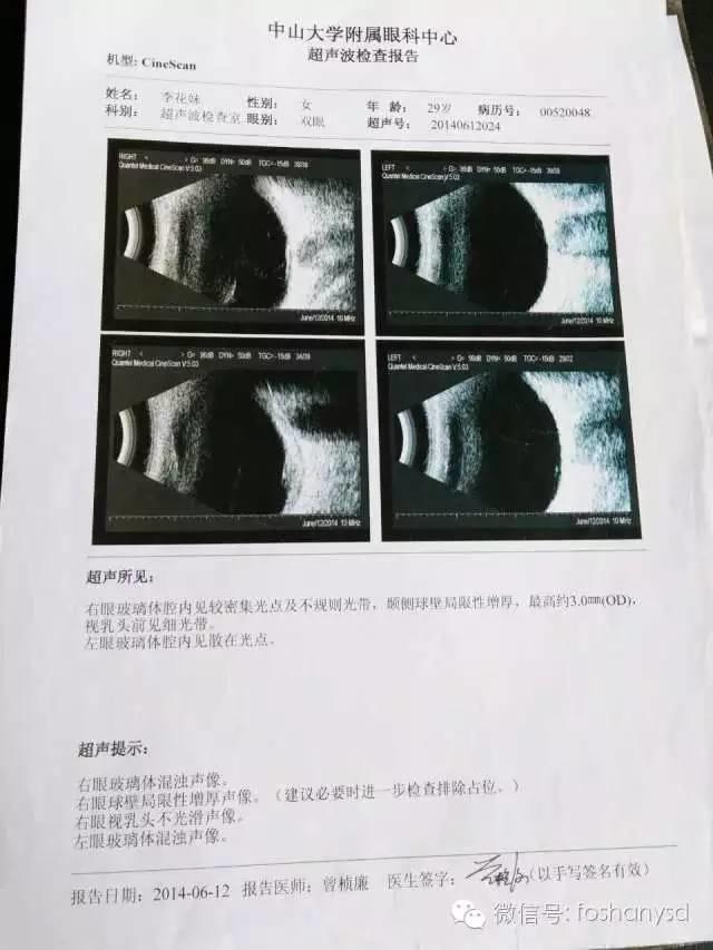 因眼睛问题用原始点调理身体一个多月，意外减肥20斤