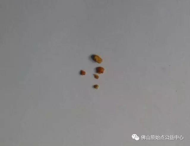 本中心学员花开深圳,原始点调理,先后自然排出肾结石 本中心学员花开深圳,原始点调理,先后自然排出肾结石