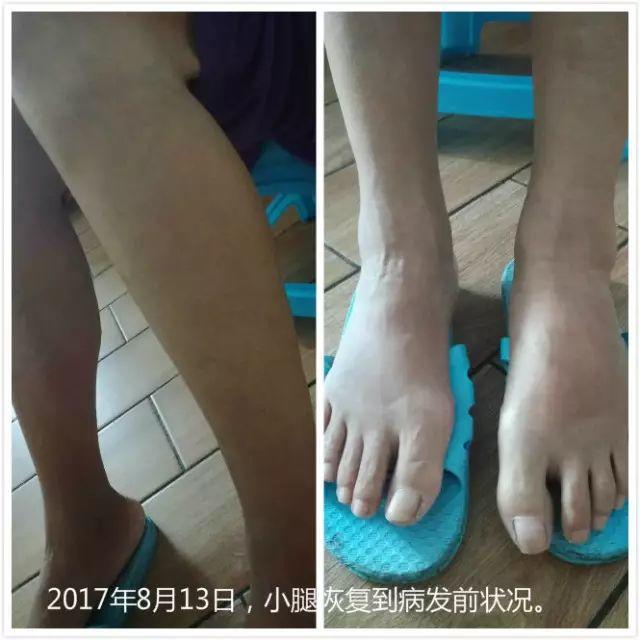 原始点调理腹水双下肢水肿:清晰的观念+信心 成就健康 原始点调理腹水双下肢水肿:清晰的观念+信心 成就健康