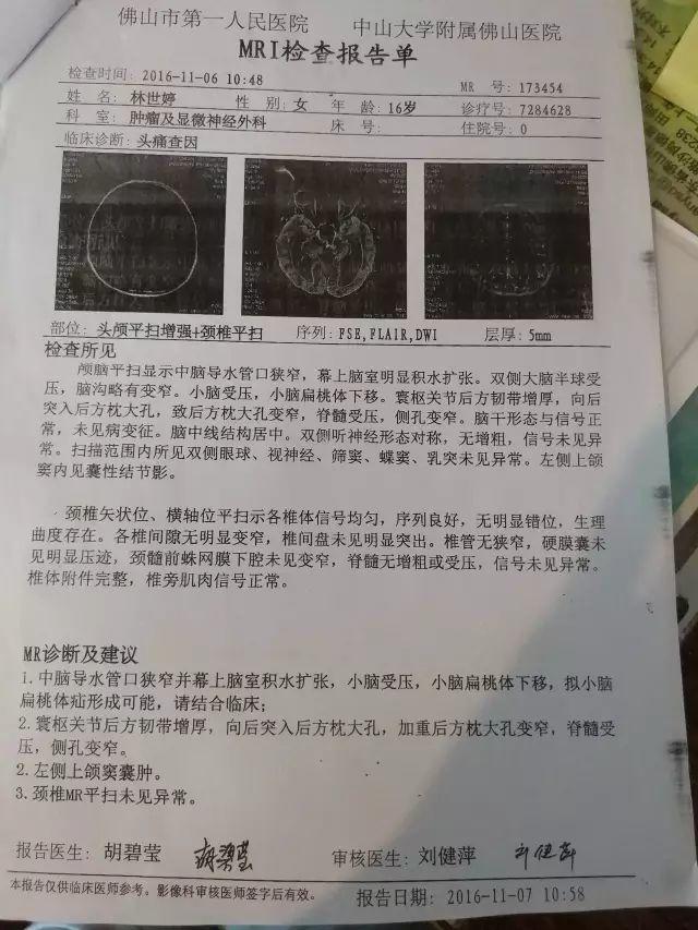 原始点调理中脑管口狭窄脑积水：65天，从黑暗到光明