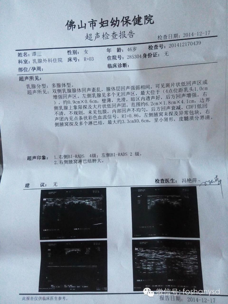 原始点调理乳腺癌三个月基本康复 原始点调理乳腺癌三个月基本康复