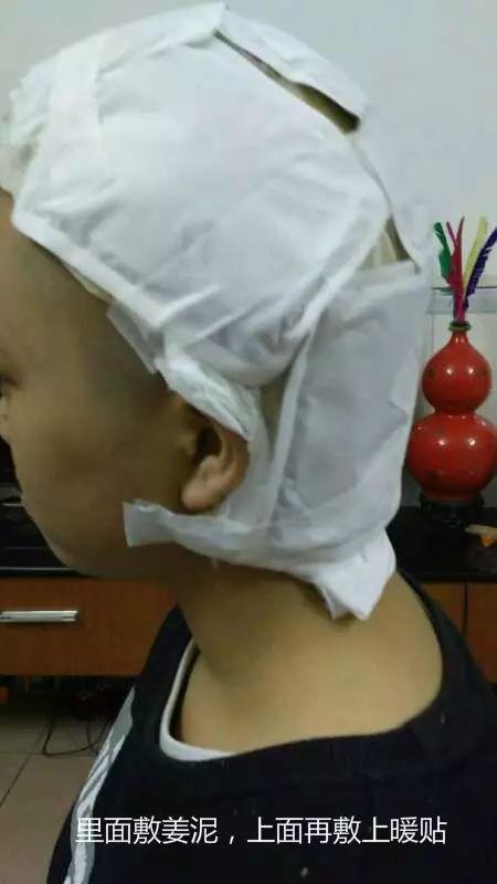 原始点调理中脑管口狭窄脑积水：65天，从黑暗到光明