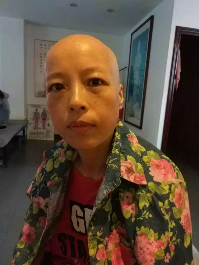 原始点调理淋巴瘤严重溃烂:无任何介入治疗愈合 原始点调理淋巴瘤严重溃烂:无任何介入治疗愈合