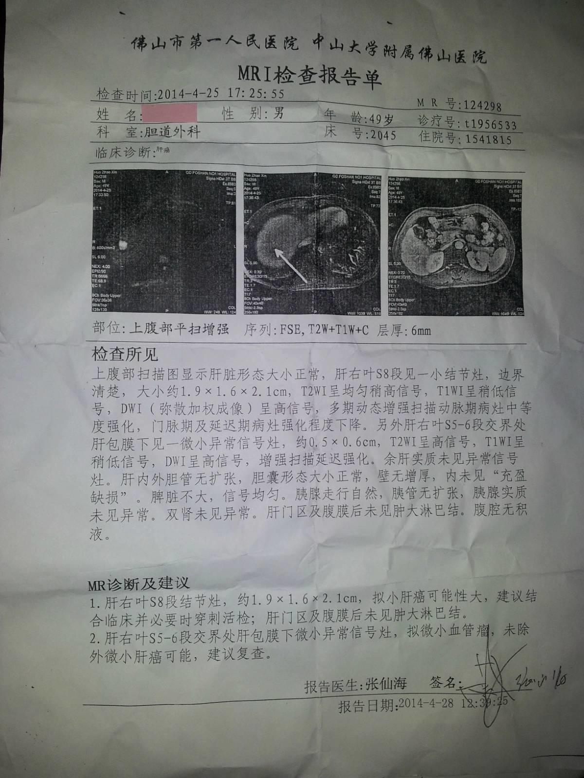 “肝癌”在原始点的呵护下65天康复 “肝癌”在原始点的呵护下65天康复