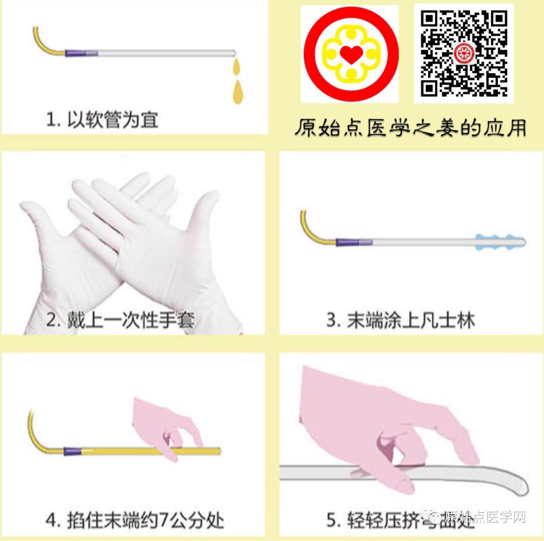 精华汇总 | 原始点医学之姜的应用（新增灌肠部分）201808第13版