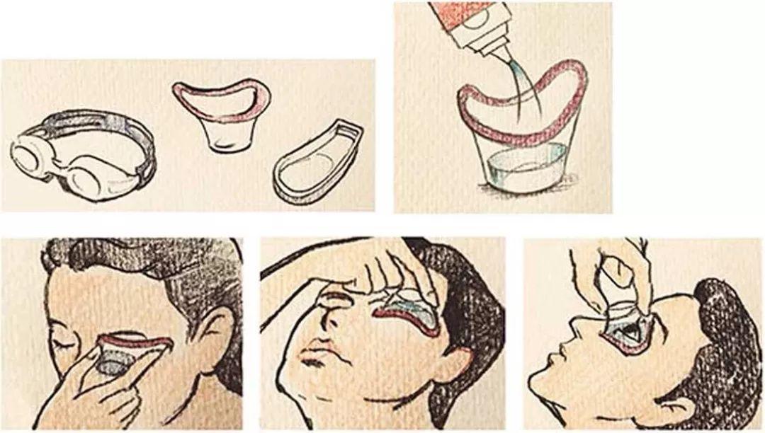 小黄姜的应用2018.12 V14 原始点医学保健