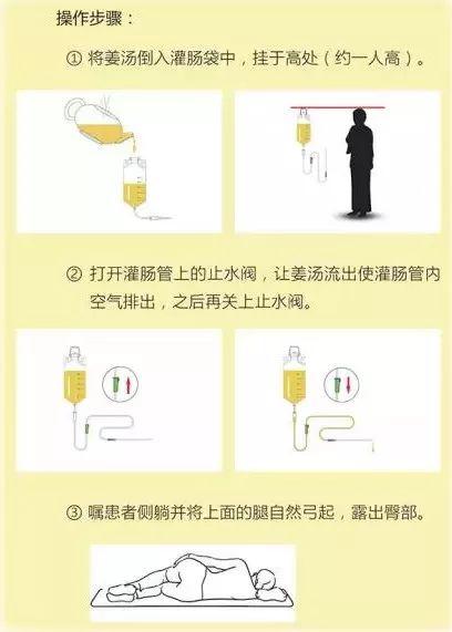 小黄姜的应用2018.12 V14 原始点医学保健