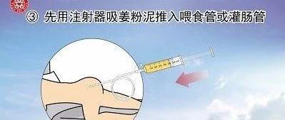 姜粉泥灌肠步骤-七不姜 生姜养生网-明德CSA生态姜园&明安农业