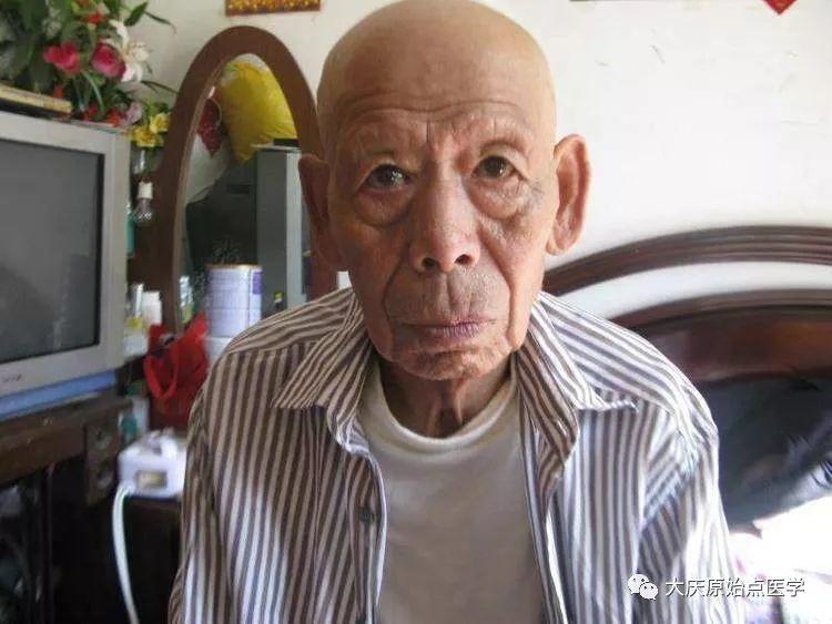 82岁老父亲车祸原始点康复