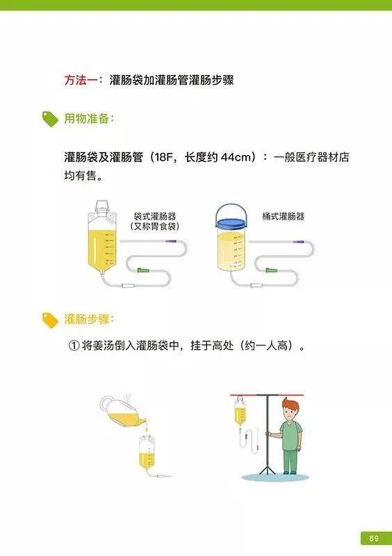 原始点姜汤灌肠步骤-更新版（2020年1月）