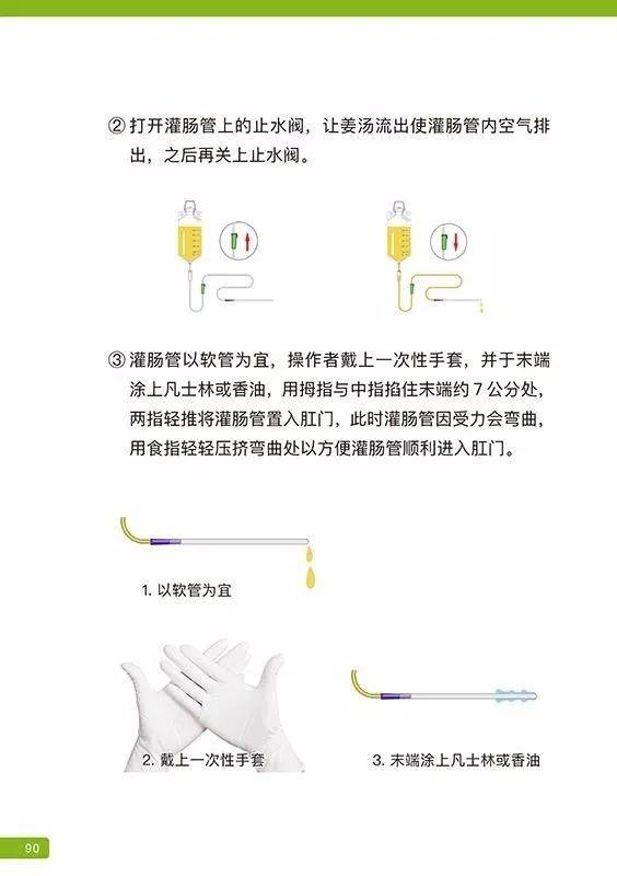 原始点姜汤灌肠步骤-更新版(2020年1月) 原始点姜汤灌肠步骤-更新版(2020年1月)