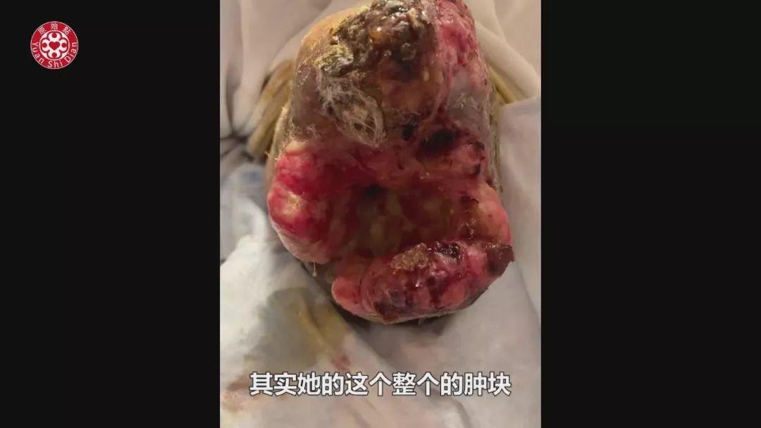 乳癌案例(2)-红肿胀痛储出血(纽约) 乳癌案例(2)-红肿胀痛储出血(纽约)