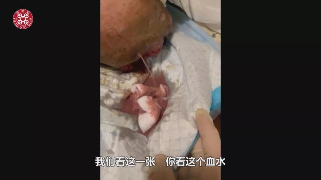 乳癌案例(2)-红肿胀痛储出血(纽约) 乳癌案例(2)-红肿胀痛储出血(纽约)