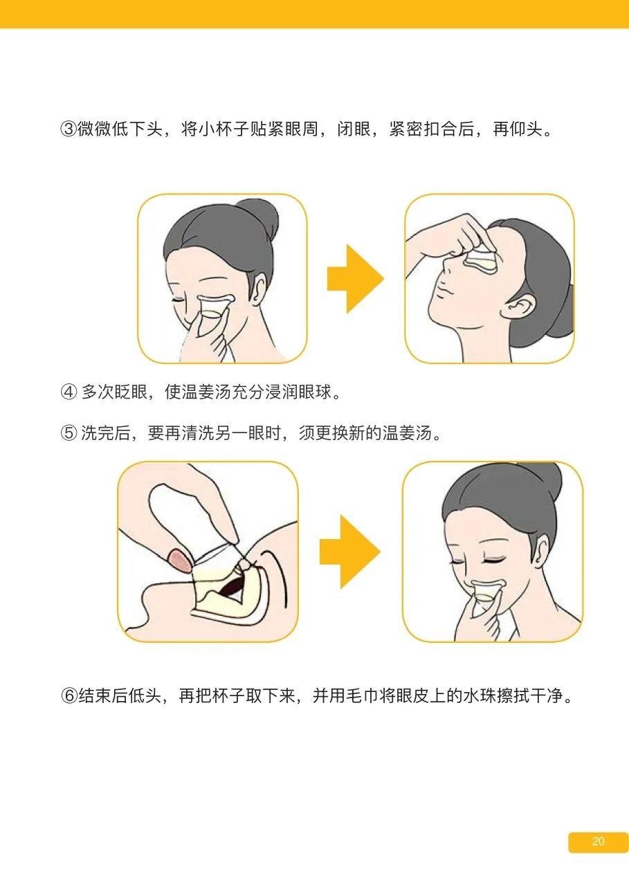 原始点姜的应用 新第16版 图片 原始点姜的应用 新第16版 图片