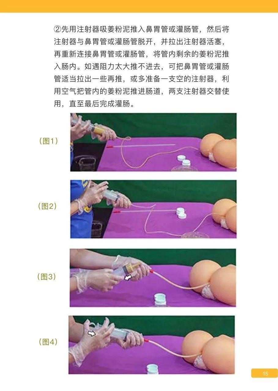 原始点姜的应用 新第16版 图片 原始点姜的应用 新第16版 图片