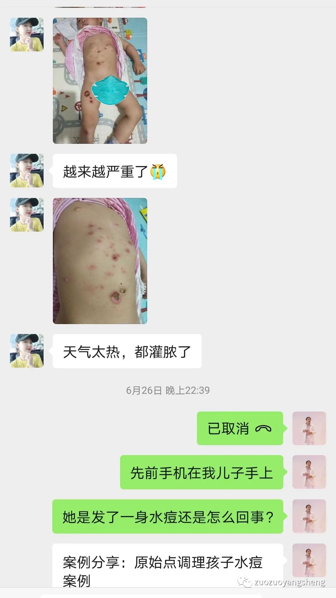 案例分享:原始点调理两岁儿童全身脓包溃烂流脓案例。 案例分享:原始点调理两岁儿童全身脓包溃烂流脓案例。