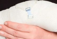 案例分享:挠骨骨折、错位,调理十天见效的案例-七不姜 生姜养生网-明德CSA生态姜园&明安农业