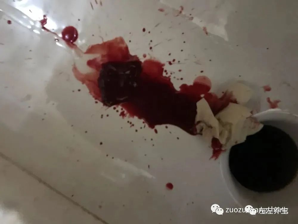 案例分享:子宫大出血调理案例 案例分享:子宫大出血调理案例