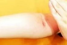 这套拍打冲击操,立秋后一定要做起来!每天一遍,百病难见!-七不姜 生姜养生网-明德CSA生态姜园&明安农业