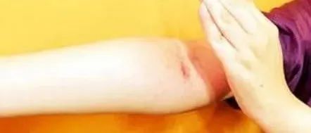 这套拍打冲击操，立秋后一定要做起来！每天一遍，百病难见！-七不姜 生姜养生网-明德CSA生态姜园&明安农业
