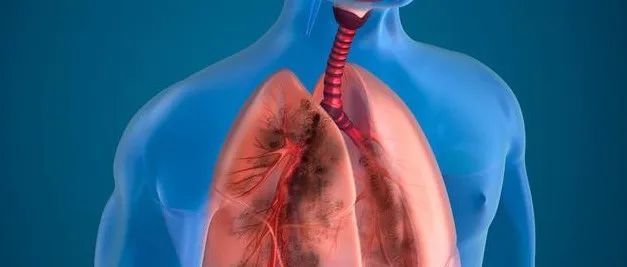 案例分享：71岁老人膀胱癌调理案例-七不姜 生姜养生网-明德CSA生态姜园&明安农业