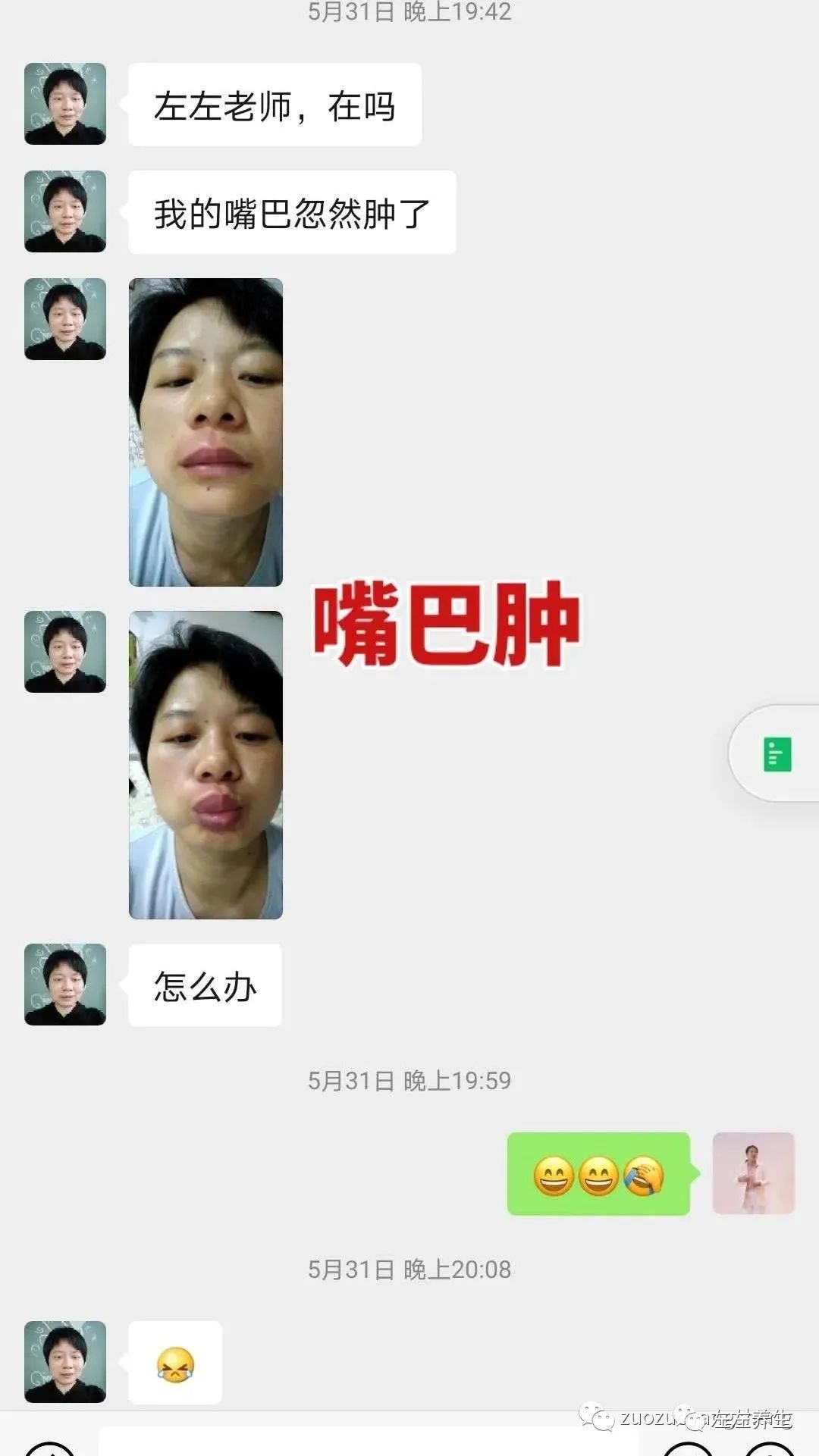 案例分享:调理荨麻疹的好转反应 案例分享:调理荨麻疹的好转反应