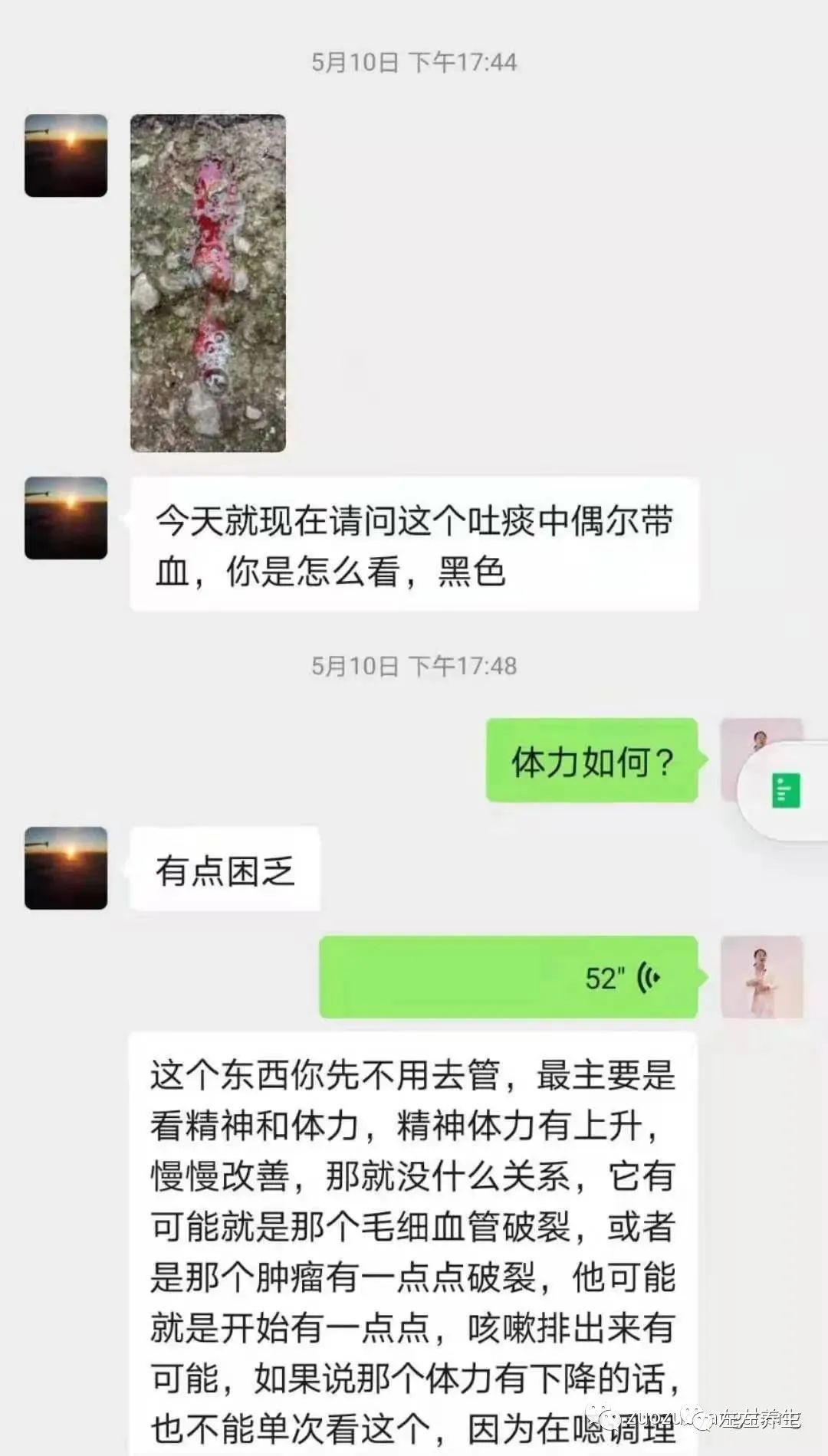 案例分享:肺癌晚期调理案例 案例分享:肺癌晚期调理案例