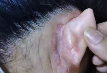 案例分享:不孕,小儿夜啼、奶水不足调理案例-七不姜 生姜养生网-明德CSA生态姜园&明安农业