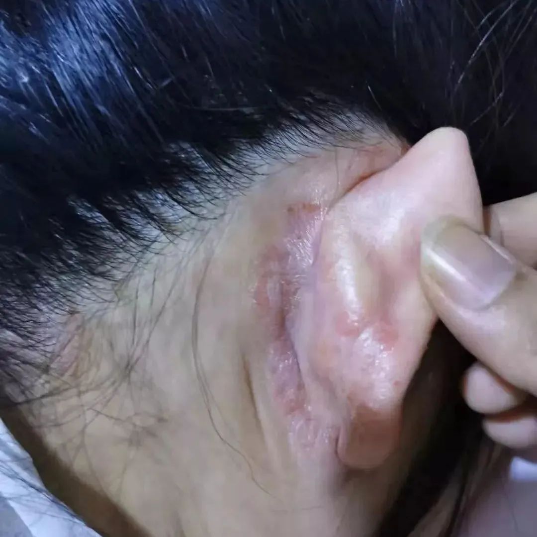 案例分享:不孕,小儿夜啼、奶水不足调理案例-七不姜 生姜养生网-明德CSA生态姜园&明安农业