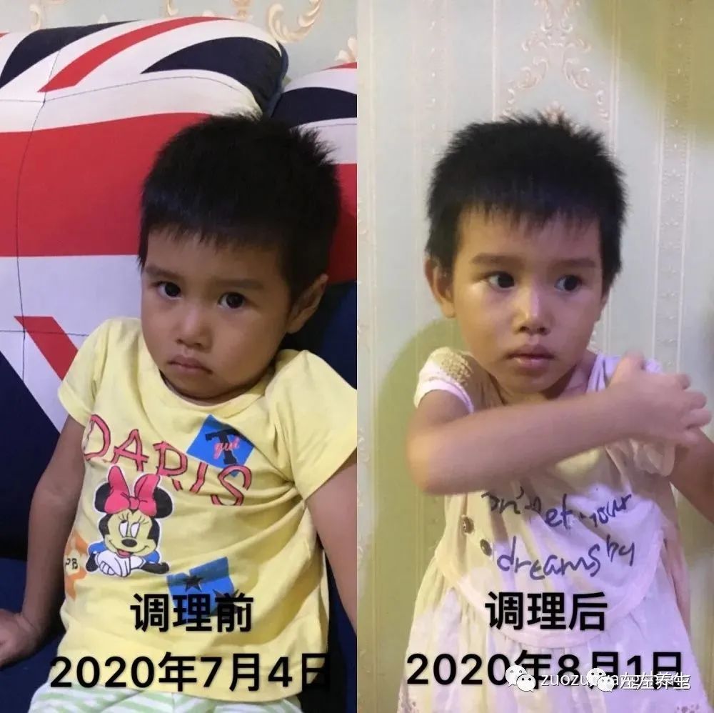 案例分享:学员李女士学习与践行自然疗法的心路历程 案例分享:学员李女士学习与践行自然疗法的心路历程