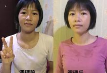 案例分享:学员李女士学习与践行自然疗法的心路历程-七不姜 生姜养生网-明德CSA生态姜园&明安农业