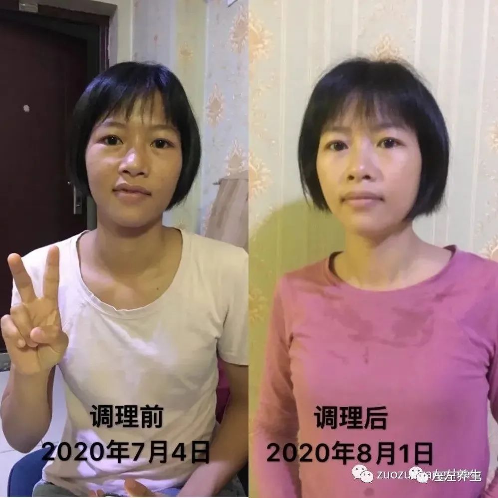 案例分享：学员李女士学习与践行自然疗法的心路历程-七不姜 生姜养生网-明德CSA生态姜园&明安农业