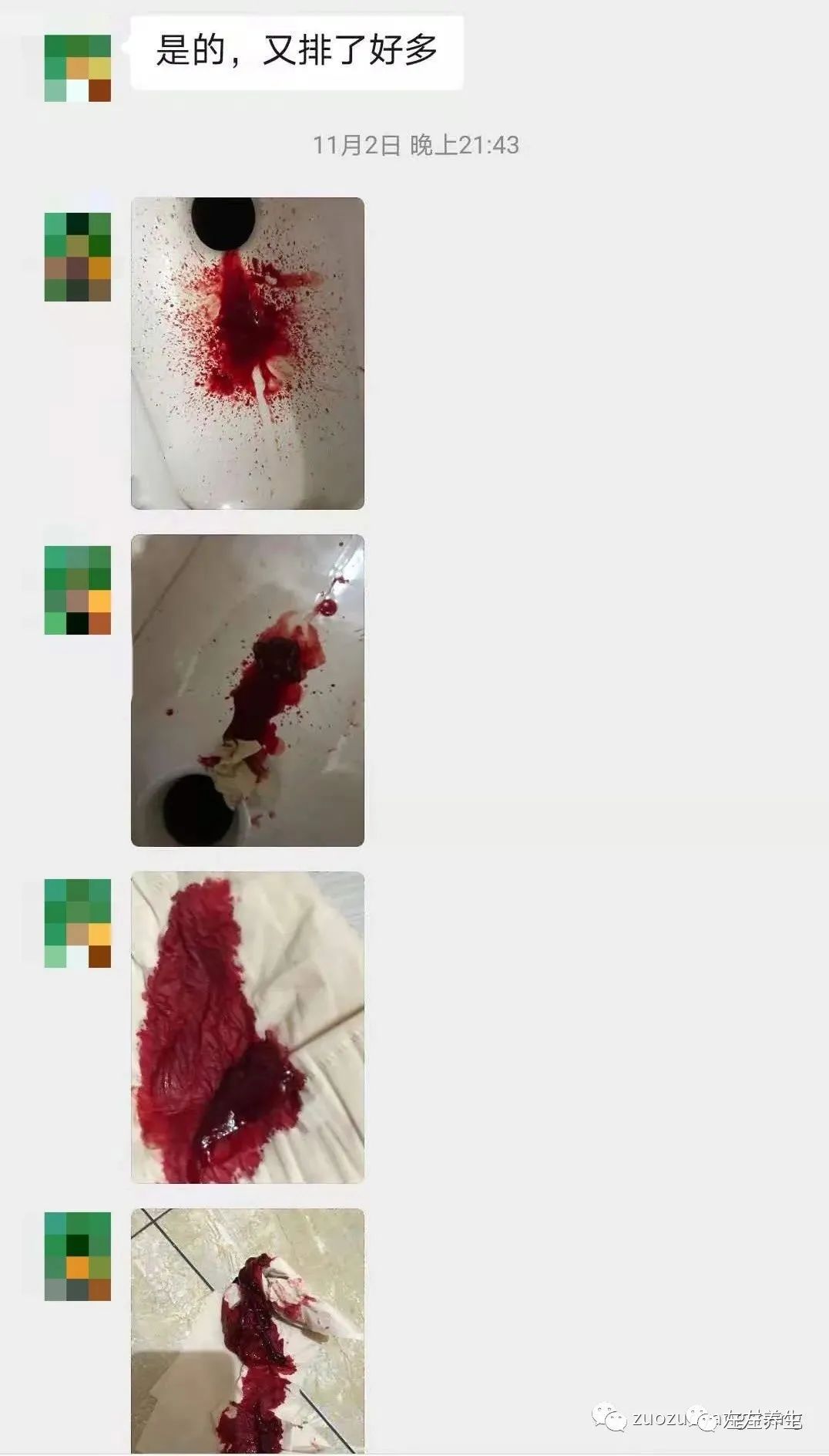 案例分享:子宫大出血调理案例 案例分享:子宫大出血调理案例