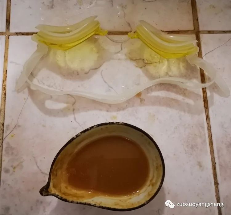 原始点案例：调理视物模糊