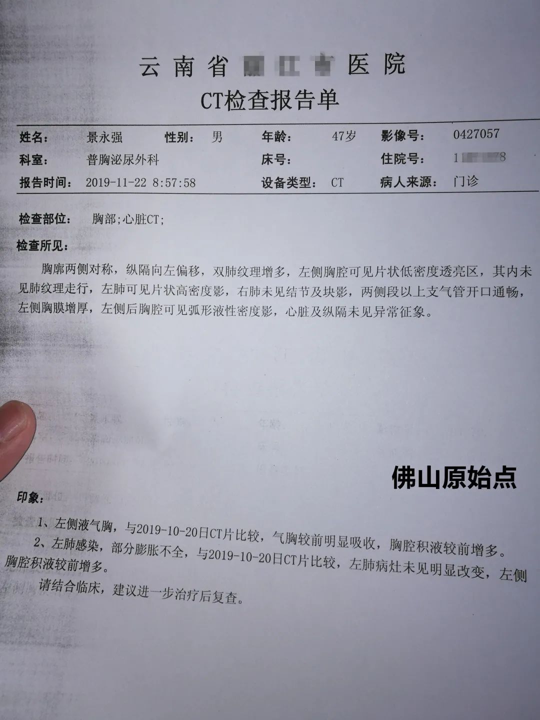 原始点调理胸腔积液案例 原始点调理胸腔积液案例