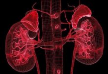 微问答26期:肾衰竭患者配合程度不高怎么办?-七不姜 生姜养生网-明德CSA生态姜园&明安农业