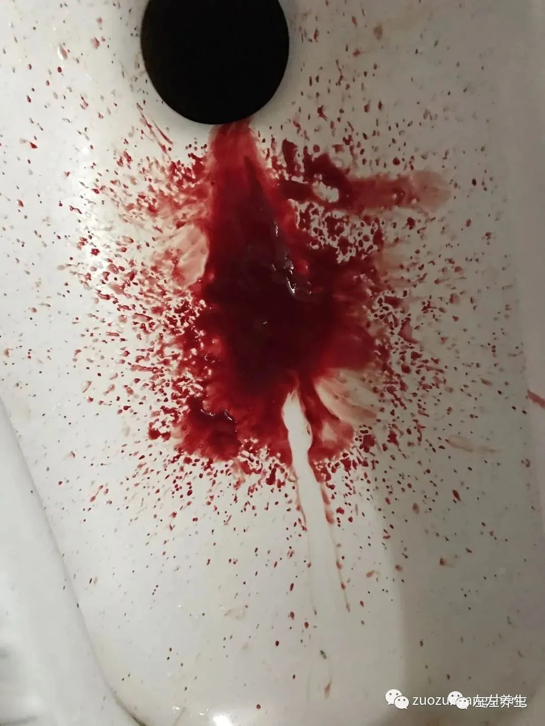 案例分享:子宫大出血调理案例 案例分享:子宫大出血调理案例