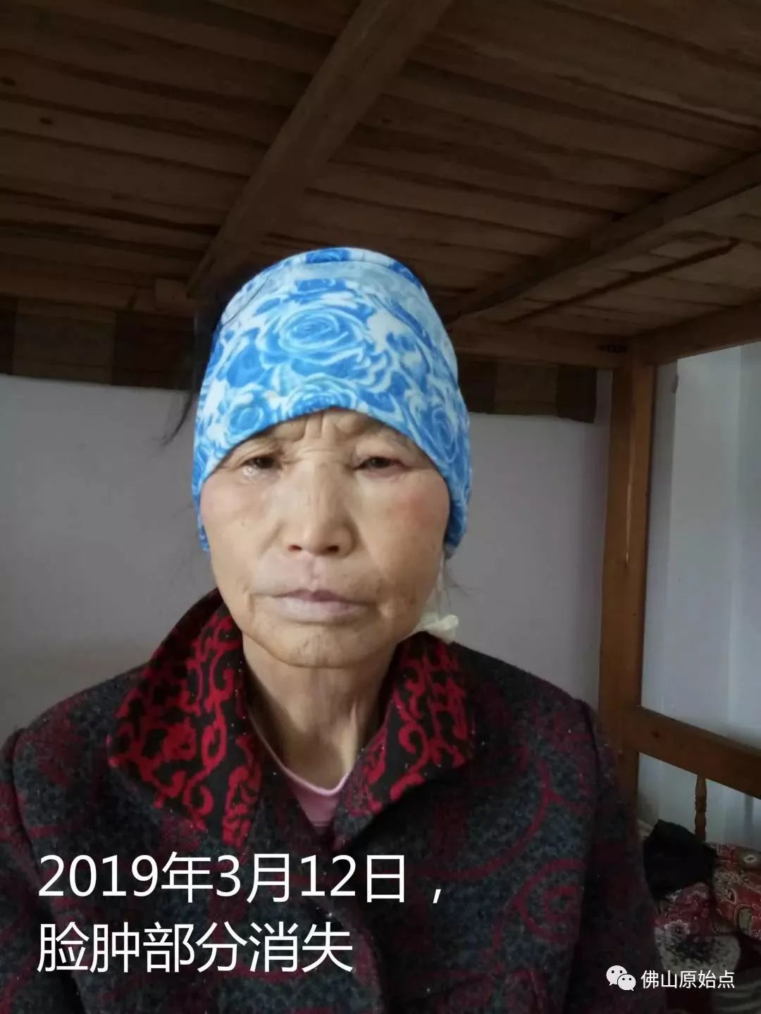 原始点调理牙痛案例 原始点调理牙痛案例