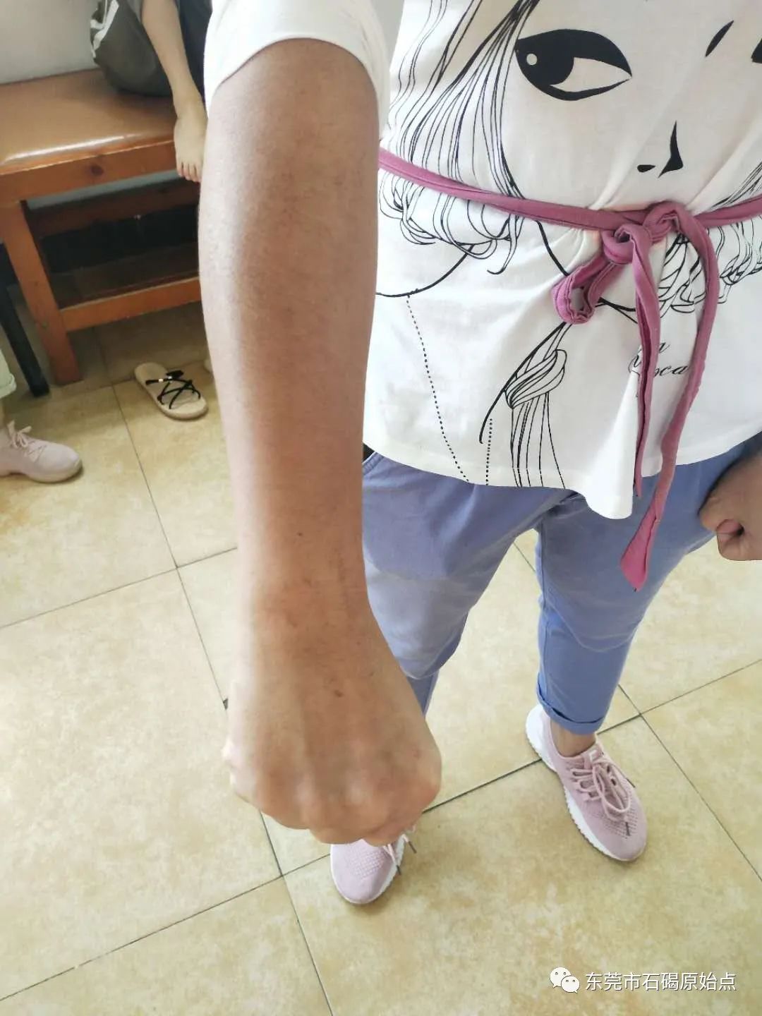 双手肿,胀痛,原始点调理3天康复 双手肿,胀痛,原始点调理3天康复