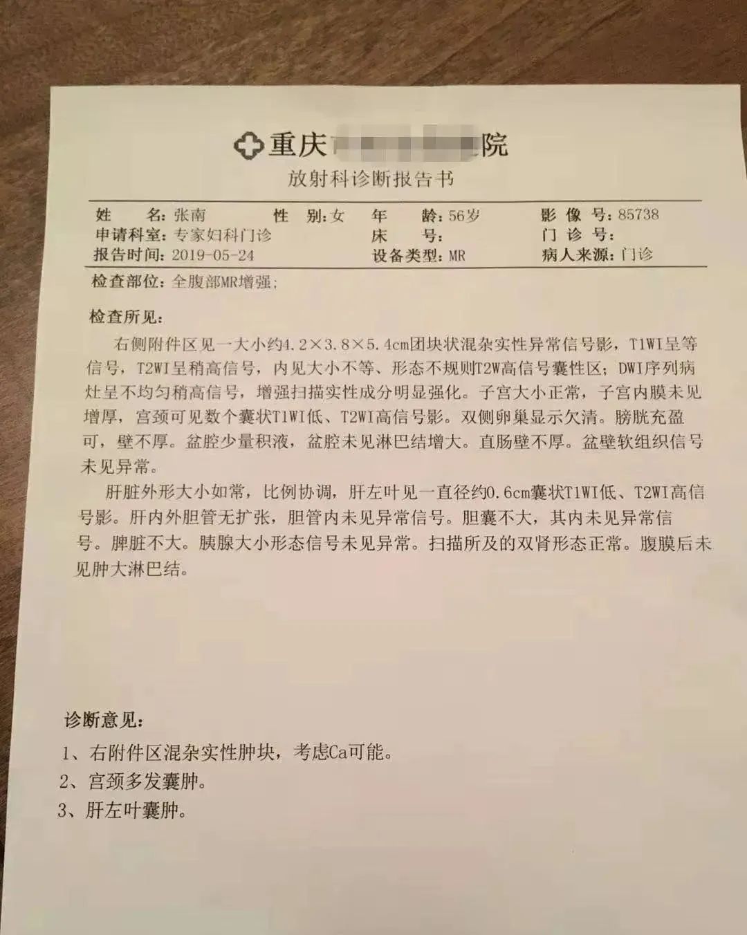 【原始点案例】用原始点调理附件肿瘤案例！