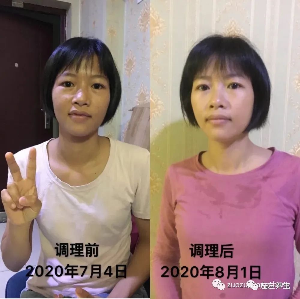 案例分享:学员李女士学习与践行自然疗法的心路历程 案例分享:学员李女士学习与践行自然疗法的心路历程