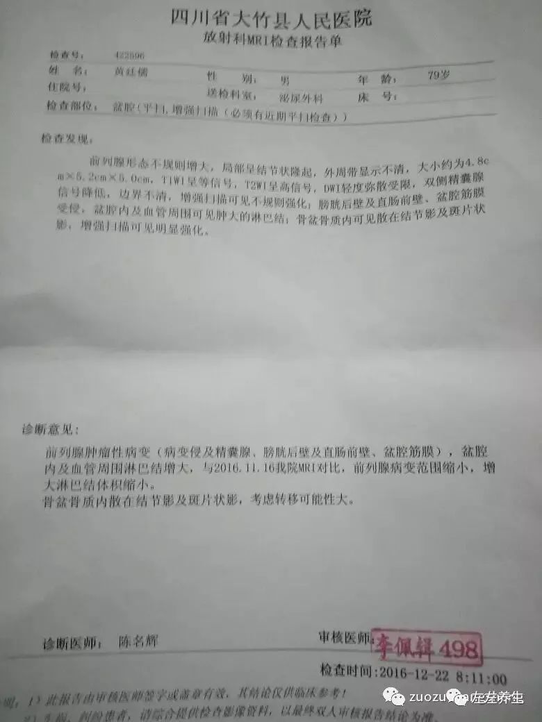 案例分享:前列腺癌的调理案例 案例分享:前列腺癌的调理案例