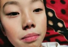 案例分享:儿童淋巴结肿大、腺样体肥大、张嘴呼吸的案例-七不姜 生姜养生网-明德CSA生态姜园&明安农业