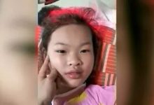 案例分享:儿童十年便秘调理案例-七不姜 生姜养生网-明德CSA生态姜园&明安农业