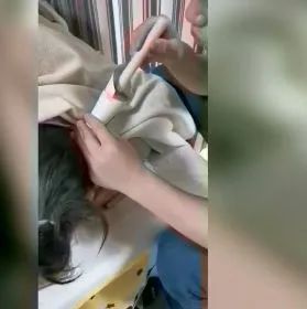案例分享：调理荨麻疹的好转反应-七不姜 生姜养生网-明德CSA生态姜园&明安农业